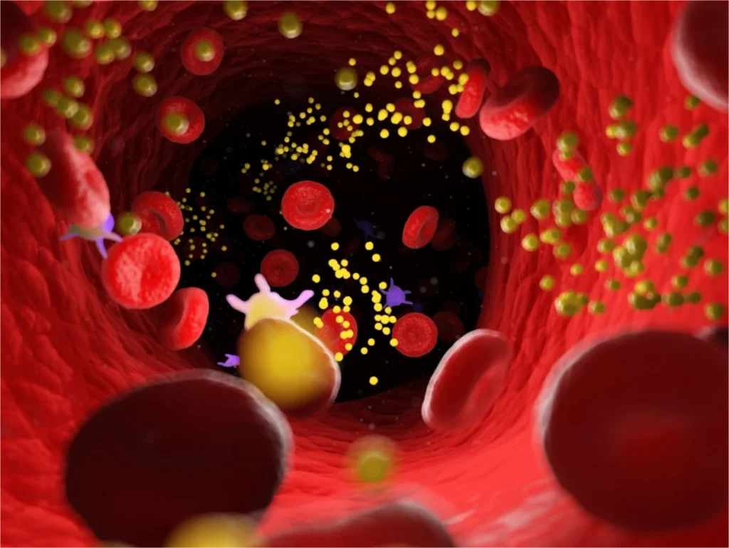Flusso di sangue in cui sono presenti molti lipidi
