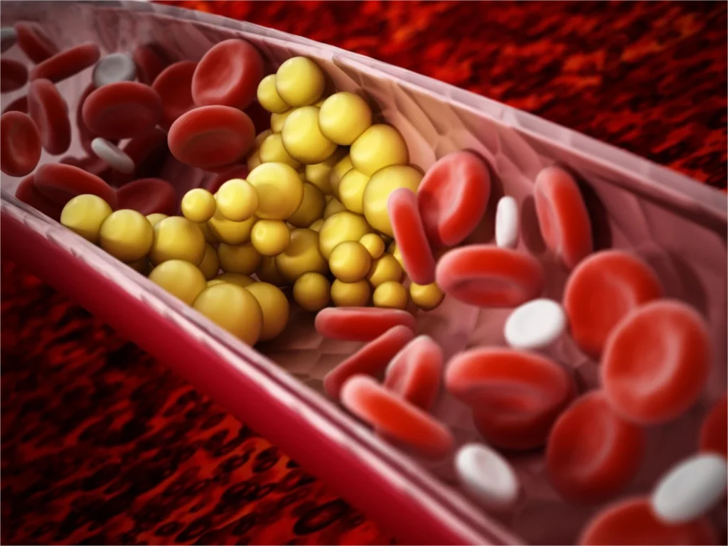 Rappresentazione del picco lipemico che avviene nel momento in cui i lipidi raggiungono il sangue