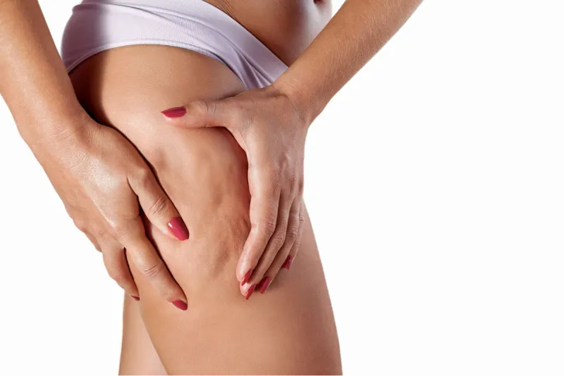 Donna con ritenzione idrica che si stringe la coscia